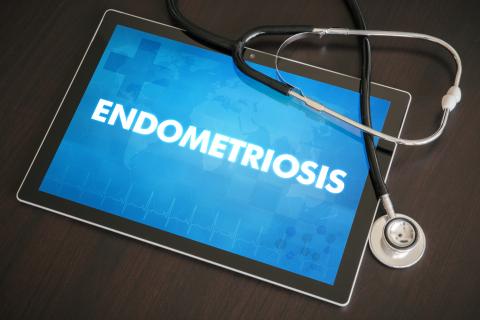 Endometriosis: What is it and how should it be treated?