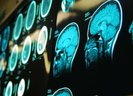Neurological care services thumbnail depicting a neurologist analyzing brain scans with a patient in a clinic